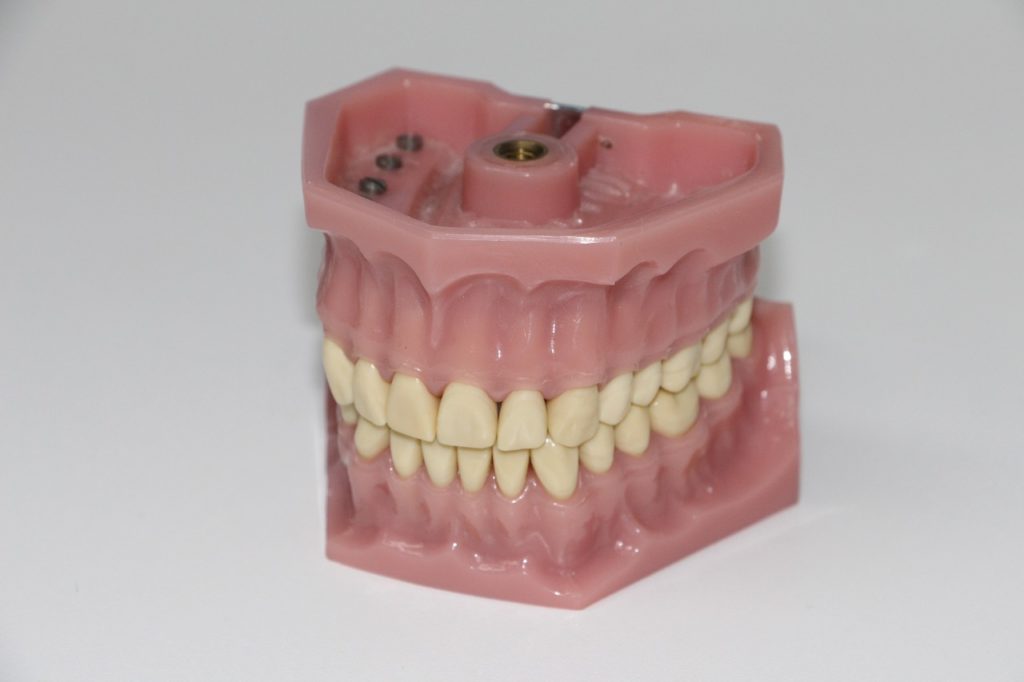 dentures, art dentures, put the bite